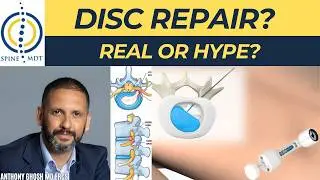 Can Gel Injections Really Repair Spinal Discs?