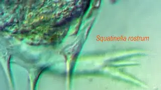 Squatinella rostrum