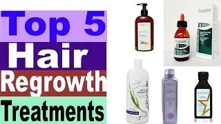 Top 5 Best Hair Regrowth Treatments For Men 2019-2020