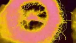 DJ Stomp - Epidome (Legacy Mix) 2010 w/ Original Video