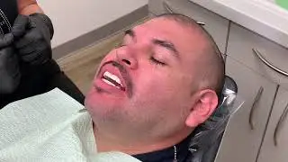 Houston Cosmetic Dentist...Have nice upper teeth but don't like bottom teeth??