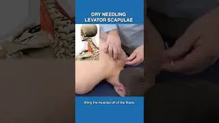 Как сушить иглу для поднимающей лопатки