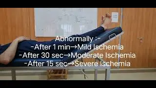 زياد الغزاوي | فيديو 13 | Pallor Test or Rubber of  dependency or burger's Test