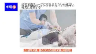 ５/６　胃ろうによる経管栄養（半固形）