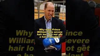 Why does Prince William have severe hair loss but not get a hair transplant #PrinceWilliam #royal