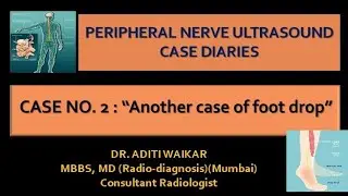 Peripheral Nerve Ultrasound Case Diaries: 