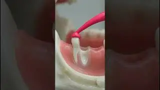 Why Cut a Tooth in HALF? 😱