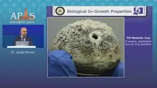 TM Cups: what is special about them? - Dr. Javad Parvizi