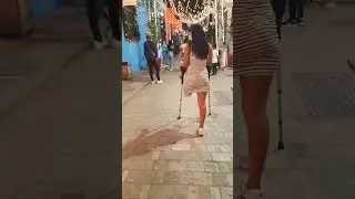 amputee crutching #amputationjourney #fashion#artificiallimb #stumping #viralvideo#coto#foot #viral
