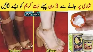 Tibet Snow Cream Formula to Get Beauty & Fairness Review - Acne & Pimples Urdu Hindi