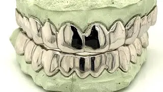12 Top 12 Bottom Sterling Silver Grillz Set by Seattle Gold Grills