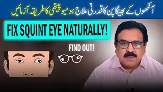 Squint (Strabismus) Eye Treatment Without Surgery Is It Possible |explain by Dr Ishrat Naeem Bhatti