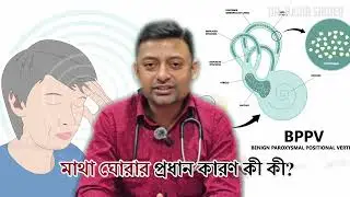 Top Reasons for Dizziness & Best Exercises for Cervical Spondylosis Vertigo!