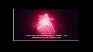 management of temporary pacemaker in ICU (Part 6)
