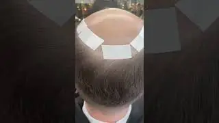 Hair System Fitting 101 | Step by Step Guide | Lavivid Hair System