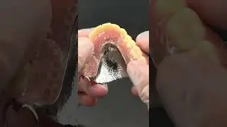 How Cobalt Chrome Denture Frameworks Reduce Fracture Risk. #dentallab #cocrdenture