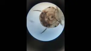 observation of mosquito ( larva stage) in microscop.