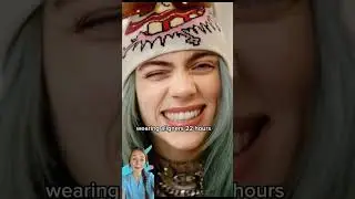 Преображение Билли Айлиш с помощью системы Invisalign