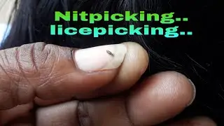 Routine nitpicking vedio//Telugu netpicking//licepicking for women...