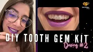 DIY Tooth Gem Kit - Step by Step - Heart Design