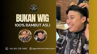 Pasang Hair System M Shape | Hairline Balik Lagi