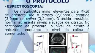RM DE PR&Oacute;STADA   Estudo Multiparam&eacute;trico