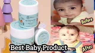 Best Baby Products🔥||Baby Skin Whitening Body Butter🔥|For Healthy Bright Skin|SKYLIGHT|100% Results🔥