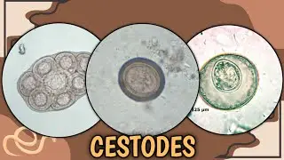 Parasitology Quiz #2 | Cestodes