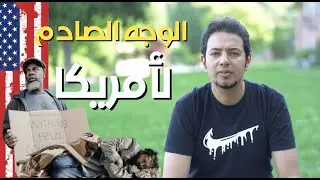 الوجه الحقيقي الصادم لأمريكا - حقائق صدمت المهاجرين الجدد للولايات المتحدة الأمريكية؟