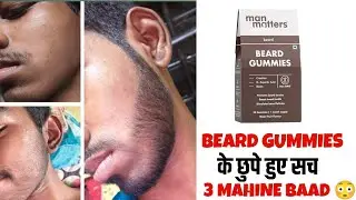 Sirf Gummies se Beard Grow Possible? | Man matters beard gummies review | beard growth tips |