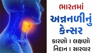 All About Esophagus Cancer by Dr Jigar Jariwala - Best GI Cancer Surgeon in Surat