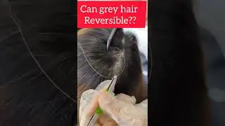 how to turn grey hair into black permanently naturally in tami| white hair problems