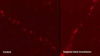 Targeted Gas5 variant knockdown leads to increased mobility of G3bp2 containing RNA granules