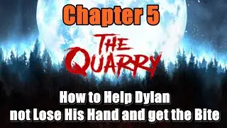 The Quary Chapter 5 How to Help Dylan Not Lose His Hand or Get the Bite