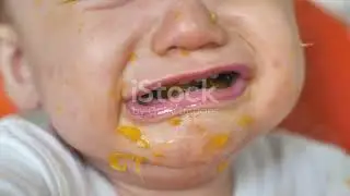 Cleft Lip & Palate