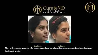 CurateMD Skin Bar and Wellness Clinic- Dermal Filler in Chandler, AZ