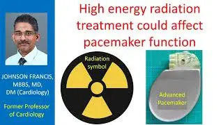 High energy radiation treatment could affect pacemaker function