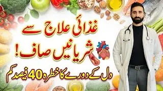 80% Heart Attacks Ki Asli Wajah | Blood Clots vs Cholesterol | Heart Attack Prevention Tips
