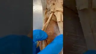 Awesome Muscle Deep In Your Forearm! Institute of Human Anatomy