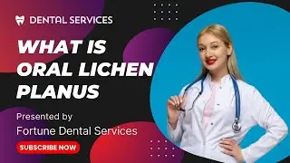 WHAT IS ORAL LICHEN PLANUS 2024? | Fortune Dental Services
