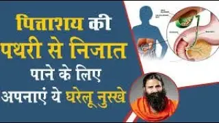 Gallbladder & Kidney Stones - Baba Ramdev - NDTV
