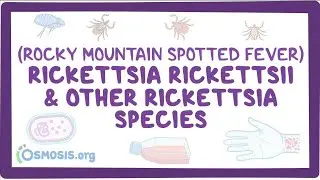 Rickettsia prowazekii.