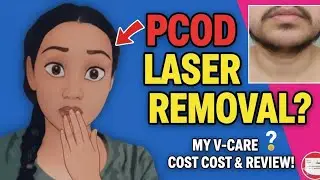 PCOS కారణంగా unwanted hair? 🙈 | V care lo Laser Hair Removal full experience in Telugu | Honest Vlog