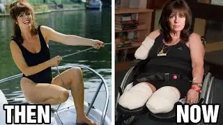 'Allo 'Allo! (1982) Actors Who Have Tragically Passed Away, Then And Now 2025!