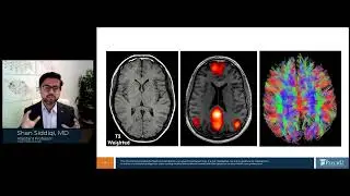 Neurocircuitry Of Depression