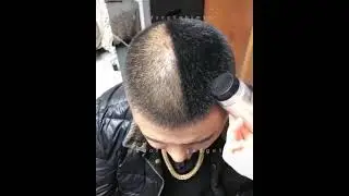 Hide baldness with hair powder