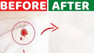 How to Get Dried Blood out of Clothes with Baking Soda & Vinegar.