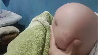 How To Massage Amputee Stump - One Legged SAK Amputee Woman Stump - AK Amputee Girl Stump Massage 