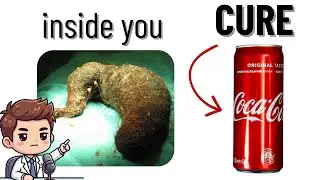 Why the heck is this STUCK inside your stomach?