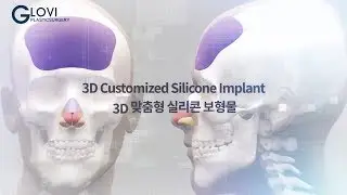 3D Fitting Nose Custom implants by  GLOVI plastic surgery